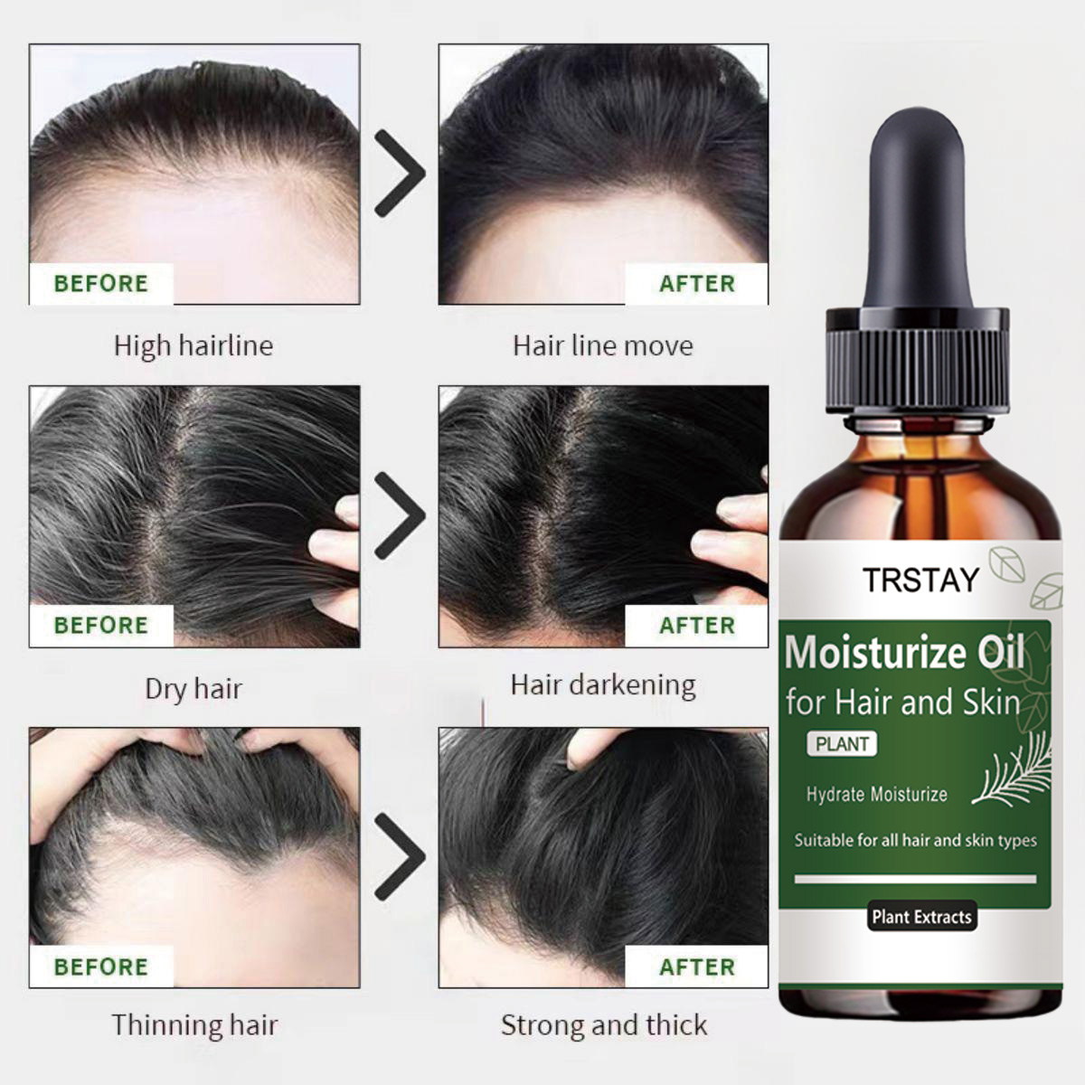 TRSTAY Rosemary Essential Oil  - огляд і ціна Rosemary Hair Oil